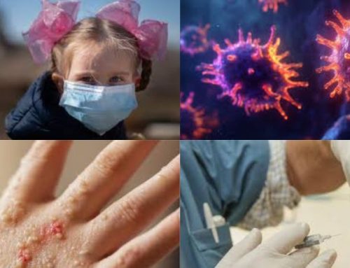 Monkeypox? No, it’s Mpox that affected 99,518! What is it?